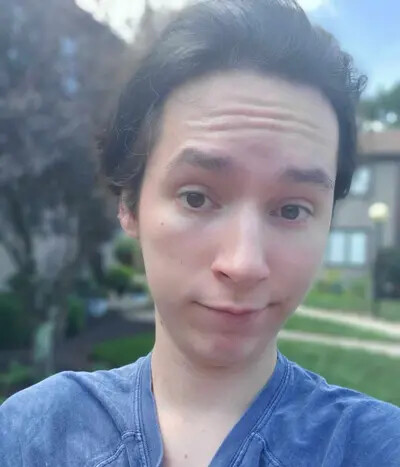 alexander lazeration cropped pic